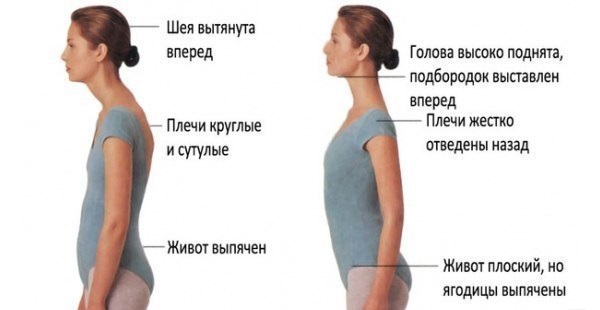 Как сделать спину ровной и не сутулится Как сделать спину ровной и не сутулится